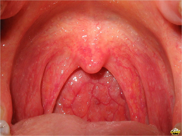 Ngủ mơ thấy cổ đánh con số lô gì?